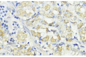 Immunohistochemistry of paraffin-embedded Human stomach using CTSB Polyclonal Antibody at dilution of 1:100 (40x lens). (Cathepsin B 抗体)