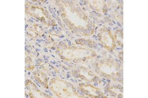 Immunohistochemistry (IHC) image for anti-Golgi-Associated, gamma Adaptin Ear Containing, ARF Binding Protein 2 (GGA2) (AA 1-300) antibody (ABIN3021665)