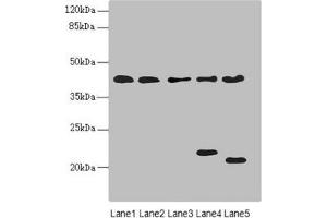 Western blot All lanes: LHX6 antibody at 3. (LHX6 抗体  (AA 114-363))