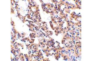 Immunohistochemistry of IL21R in rat lung with IL21R polyclonal antibody  at 10 ug/mL .