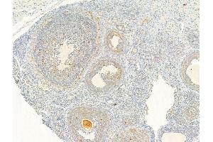 ABIN6255661 and ABIN6267025 at 1/100 staining Rat ovary tissue by IHC-P.