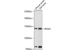 Western blot analysis of extracts of various cell lines, using R antibody (ABIN3022296, ABIN3022297, ABIN3022298 and ABIN6218715) at 1:1000 dilution.