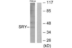 Western blot analysis of extracts from HeLa cells, using SRY antibody. (SRY 抗体  (Internal Region))