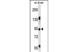 Western blot analysis in mouse liver tissue lysates (35ug/lane). (RASAL1 抗体  (AA 309-337))