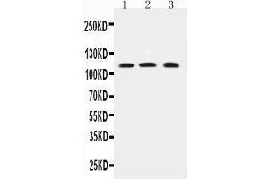 Western Blotting (WB) image for anti-Transient Receptor Potential Cation Channel, Subfamily C, Member 4 (TRPC4) (AA 961-977), (C-Term) antibody (ABIN3042531) (TRPC4 抗体  (C-Term))