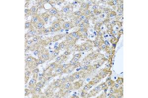 Immunohistochemistry of paraffin-embedded human liver using TMEM189 antibody (ABIN6134447, ABIN6149262, ABIN6149263 and ABIN6224423) at dilution of 1:100 (40x lens). (TMEM189 抗体  (C-Term))
