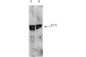 Western blot using  affinity purified anti-ECT2 pT790 antibody shows detection of endogenous phosphorylated ECT2 (arrowhead) present in cell lysates from interphase (lane 1) and mitotic (lane 2) HeLa cells. (ECT2 抗体  (pThr790))