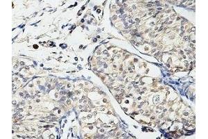 IHC analysis of formalin-fixed paraffin-embedded fetal testis, using USP29 antibody (1/100 dilution). (USP29 抗体  (AA 15-215))