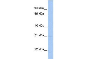 WB Suggested Anti-MMD2 Antibody Titration: 0. (MMD2 抗体  (N-Term))