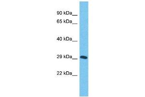 Host:  Rabbit  Target Name:  ZNF625  Sample Type:  Stomach Tumor lysates  Antibody Dilution:  1. (ZNF625 抗体  (Middle Region))