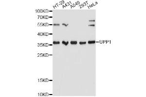 Western blot analysis of extracts of various cell lines, using UPP1 Antibody. (UPP1 抗体)