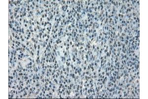 Image no. 1 for anti-Crystallin, alpha B (CRYAB) antibody (ABIN1497645) (CRYAB 抗体)