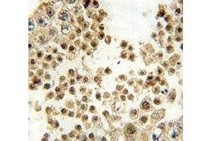 IHC analysis of FFPE human testis tissue stained with ACE2 antibody
