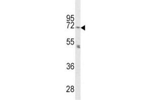 Western Blotting (WB) image for anti-Proprotein Convertase Subtilisin/kexin Type 2 (PCSK2) (AA 87-116) antibody (ABIN3032332)