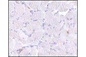 Immunohistochemistry of LIMP2 in human skeletal muscle tissue with this product at 10 μg/ml. (SCARB2 抗体  (C-Term))