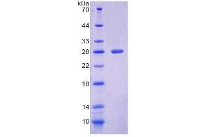 SDS-PAGE analysis of Mouse NCR1 Protein. (NCR1 蛋白)