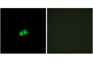 Immunofluorescence analysis of A549 cells, using COPS2 Antibody. (COPS2 抗体  (AA 181-230))