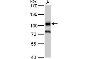 WB Image CD19 antibody detects CD19 protein by western blot analysis. (CD19 抗体)