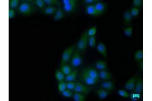Immunofluorescence staining of Hela cells with ABIN7140130 at 1:133, counter-stained with DAPI. (TBK1 抗体  (AA 644-661))