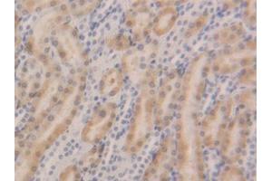 DAB staining on IHC-P; Samples: Rat Kidney Tissue (GSTa5 抗体  (AA 1-221))