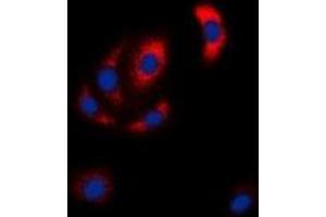 Immunofluorescent analysis of MKK6 staining in Hela cells. (MAP2K6 抗体  (N-Term))