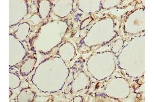 Immunohistochemistry of paraffin-embedded human thyroid tissue using ABIN7166396 at dilution of 1:100 (PADI3 抗体  (AA 1-664))