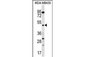 Western blot analysis in MDA-MB435 cell line lysates (35ug/lane). (Sorting Nexin 4 抗体  (C-Term))