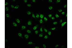 Immunofluorescence staining of Hela cells with ABIN7127715 at 1:100,counter-stained with DAPI. (Recombinant MTOR 抗体  (pSer2481))
