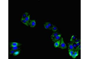 Immunofluorescent analysis of HepG2 cells using ABIN7171759 at dilution of 1:100 and Alexa Fluor 488-congugated AffiniPure Goat Anti-Rabbit IgG(H+L) (TNMD 抗体  (AA 131-254))
