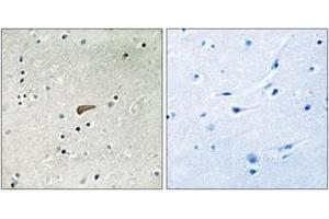 Immunohistochemistry (IHC) image for anti-Fibroblast Growth Factor Receptor Substrate 2 (FRS2) (AA 402-451), (pTyr436) antibody (ABIN1532103)
