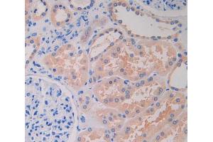 IHC-P analysis of kidney tissue, with DAB staining. (LRRFIP1 抗体  (AA 615-735))