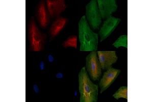 ABIN6262847 and ABIN6278586 staining  cells by IF/ICC.