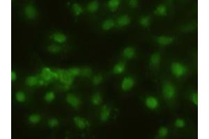 Immunofluorescent staining of HeLa cells using anti-HHex mouse monoclonal antibody (ABIN2452382). (HHEX 抗体  (AA 100-270))