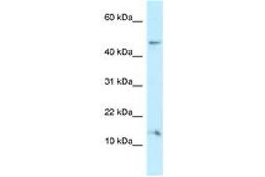 Image no. 1 for anti-Pleckstrin Homology Domain Containing, Family J Member 1 (PLEKHJ1) (AA 86-135) antibody (ABIN6747910) (GNRPX 抗体  (AA 86-135))
