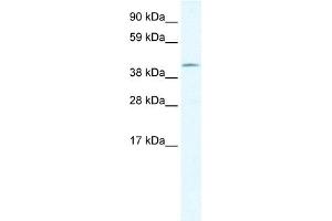 WB Suggested Anti-GIOT-1 Antibody Titration:  1. (ZNF461 抗体  (N-Term))