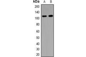 Western blot analysis of USP37 expression in HeLa (A), mouse brain (B), rat brain (C) whole cell lysates. (USP37 抗体)