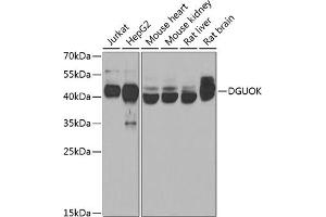 Western blot analysis of extracts of various cell lines, using DGUOK antibody  at 1:1000 dilution. (Deoxyguanosine Kinase 抗体  (AA 40-277))
