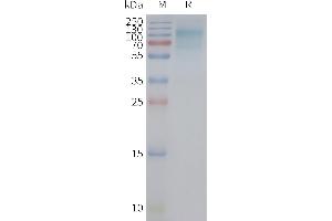 SDS-PAGE (SDS) image for Solute Carrier Family 2 (Facilitated Glucose Transporter), Member 12 (SLC2A12) protein (ABIN7491731)