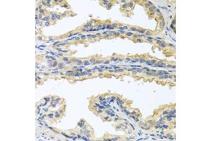 Immunohistochemistry of paraffin-embedded human prostate using OSM antibody (ABIN5975006) at dilution of 1/100 (40x lens). (Oncostatin M 抗体)