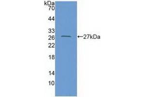 Detection of Recombinant CXADR, Human using Polyclonal Antibody to Coxsackie Virus And Adenovirus Receptor (CXADR) (Coxsackie Adenovirus Receptor 抗体  (AA 20-229))
