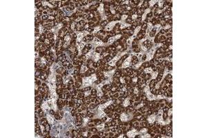 Immunohistochemical staining of human liver with ROGDI polyclonal antibody  shows strong cytoplasmic positivity in hepatocytes.