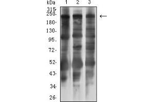 Western Blotting (WB) image for anti-Myosin Light Chain Kinase (MYLK) (AA 1375-1524) antibody (ABIN7193606)