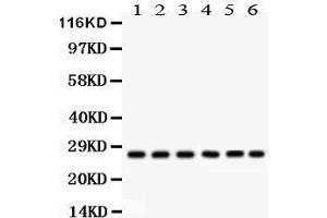 Anti- CIB1 Picoband antibody, Western blotting All lanes: Anti CIB1  at 0. (CIB1 抗体  (AA 6-191))