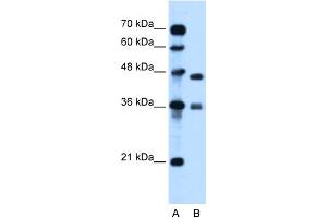 WB Suggested Anti-MPG Antibody Titration:  0. (MPG 抗体  (C-Term))