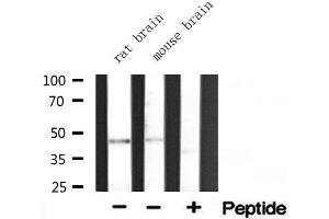 Western blot analysis of extracts of various tissue ,using ACAT1 antibody. (ACAT1 抗体  (Internal Region))