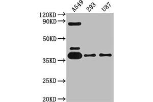 Western Blot Positive WB detected in: A549 whole cell lysate, 293 whole cell lysate, U87 whole cell lysate All lanes: ADORA1 antibody at 1:2000 Secondary Goat polyclonal to rabbit IgG at 1/50000 dilution Predicted band size: 37, 14 kDa Observed band size: 37 kDa (Recombinant ADORA1 抗体)