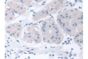 Detection of CCT2 in Human Stomach Tissue using Polyclonal Antibody to Chaperonin Containing TCP1, Subunit 2 (CCT2)