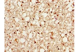 Immunohistochemistry (IHC) image for anti-Prosaposin (PSAP) (AA 311-391) antibody (ABIN7164840)