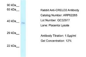 Western Blotting (WB) image for anti-Cysteine-Rich with EGF-Like Domains 2 (CRELD2) (C-Term) antibody (ABIN2789088) (CRELD2 抗体  (C-Term))