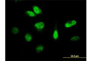 Immunofluorescence of purified MaxPab antibody to CDKN3 on HeLa cell. (CDKN3 抗体  (AA 1-212))